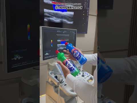 Vídeo