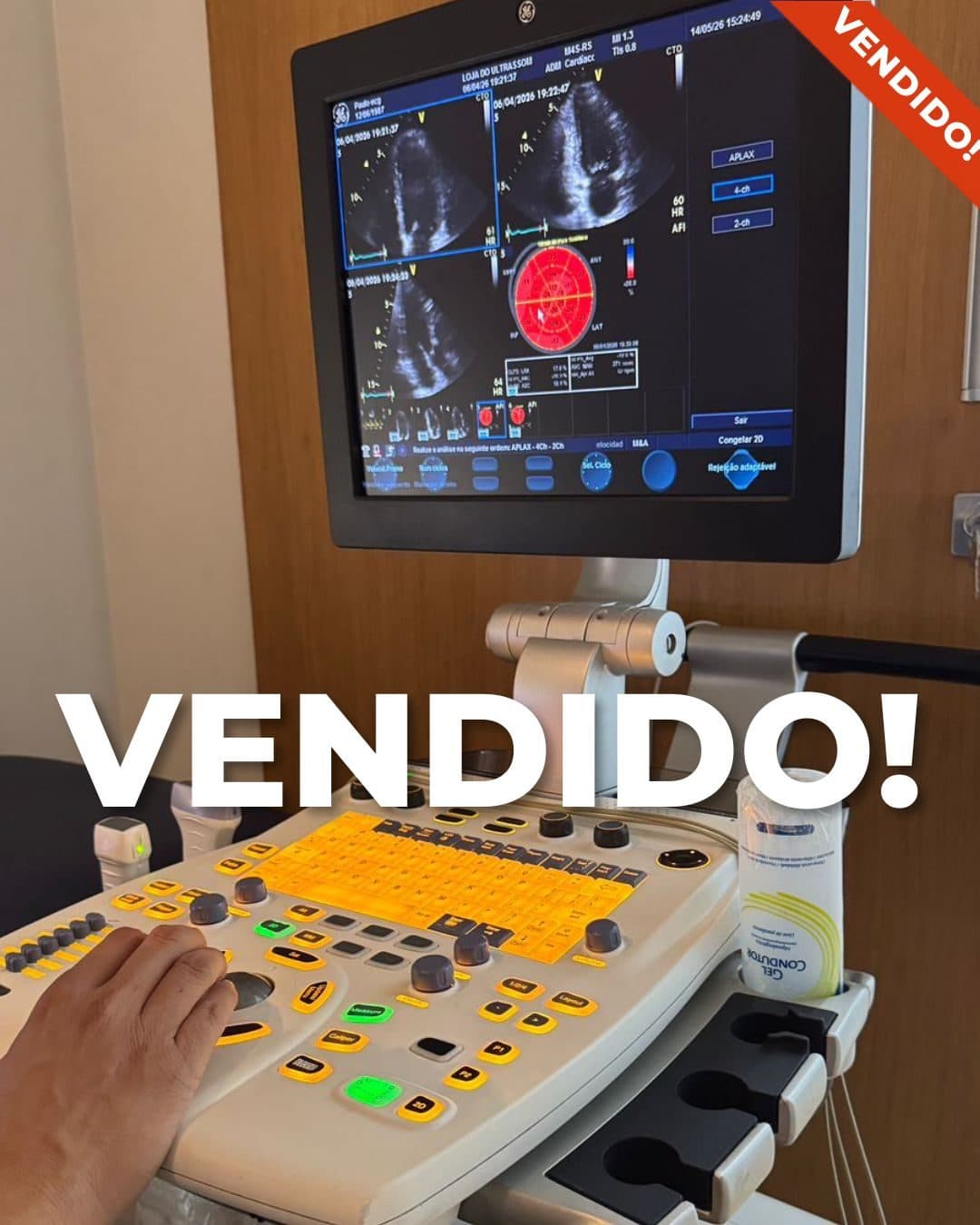 GE HealthCare VIVID S6 - 2012 — foto 1